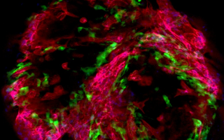Israel unveils miniature human heart model to transform drug testing