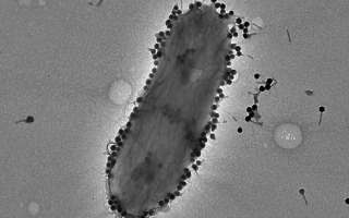 Clone of Israeli scientists say viruses can beat bacteria that resist antibiotics