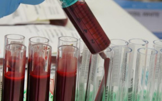 New Blood Test Offers Early Detection of Drug-Induced Tissue Damage in Cancer Patients New Blood Test Offers Early Detection of Drug-Induced Tissue Damage in Cancer Patients
