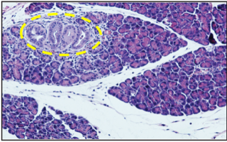 Oral Bacteria Accelerate Pancreatic Cancer Development in Mice: Research Reveals Key Findings Oral Bacteria Accelerate Pancreatic Cancer Development in Mice: Research Reveals Key Findings