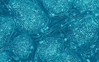 Cancer-related mutations appear in stem cell derivatives utilized in regenerative medicine