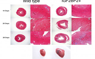 RNA Binding Protein IGF2BP2 Identified as Key Player in Stress-Induced Dilated Cardiomyopathy