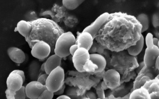 New Study Reveals How Immune Cells Help Defend Against Candida Infections