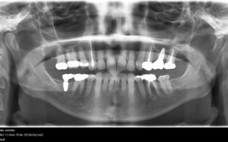 X-Raying Your Head Every Year at the Dentist Might Be Totally Unnecessary