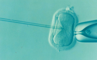 Improving the Success of IVF 