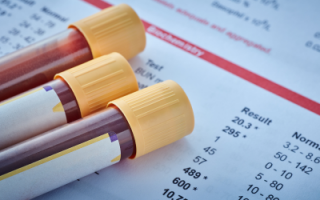A Safer Therapy for Pulmonary Embolism: Catheter Directed Thrombolysis Shows Promise in New Research