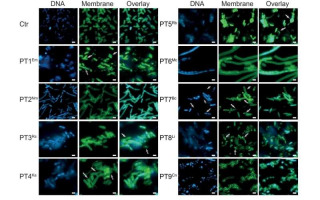 New Bacterial Toxins Discovered: A Key to Fighting Infections