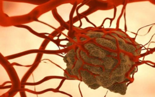 New Way to Destroy a Cancer-Linked Molecule Revealed