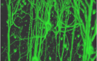 Early Detection of Parkinson’s with Novel RNA-Based Blood Test
