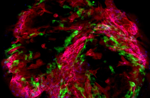 Israel unveils miniature human heart model to transform drug testing