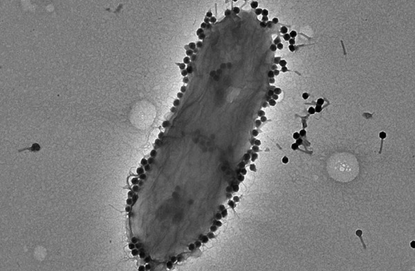 Clone of Israeli scientists say viruses can beat bacteria that resist antibiotics