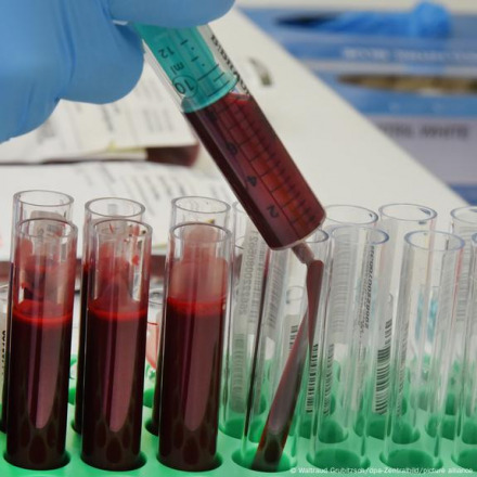 New Blood Test Offers Early Detection of Drug-Induced Tissue Damage in Cancer Patients 