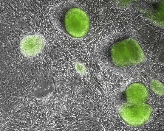 Stem Cells
