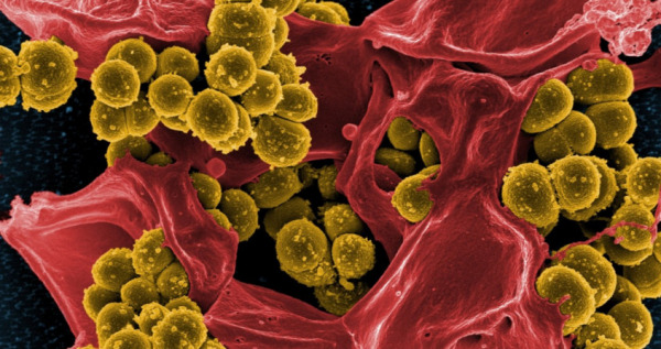 Revealing the Hidden Complexity of Bacterial Biofilms