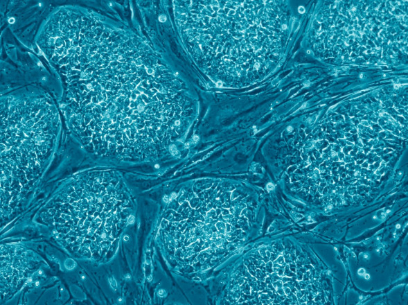 Cancer-related mutations appear in stem cell derivatives utilized in regenerative medicine