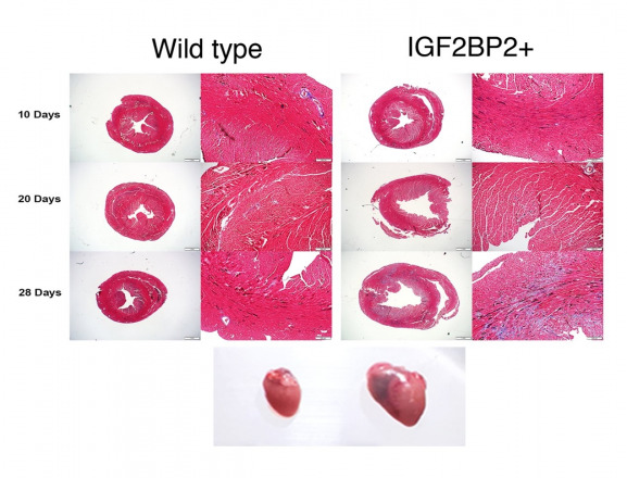 RNA Binding Protein IGF2BP2 Identified as Key Player in Stress-Induced Dilated Cardiomyopathy