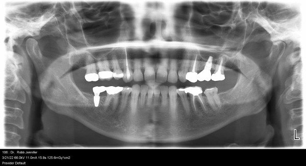 X-Raying Your Head Every Year at the Dentist Might Be Totally Unnecessary