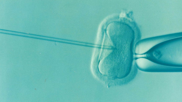 Improving the Success of IVF Improving the Success of IVF