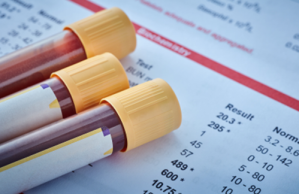 A Safer Therapy for Pulmonary Embolism: Catheter Directed Thrombolysis Shows Promise in New Research