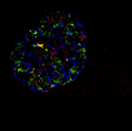 Study Uncovers Key Role of Enzyme G6PC2 in Controlling Blood Sugar by Regulating Glucagon Secretion