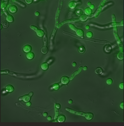 Viruses Hidden Within Fungi Could Be Secret Drivers of Deadly Lung Infections Viruses Hidden Within Fungi Could Be Secret Drivers of Deadly Lung Infections