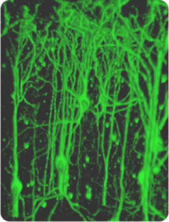 Early Detection of Parkinson’s with Novel RNA-Based Blood Test